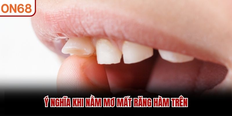 Ý nghĩa khi nằm mơ mất răng hàm trên